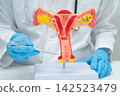 Doctor holding human uterus model for vaginal and cervix pap smear check up in the obstetrics and gynecology. 142523479