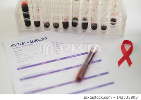HIV test serology report with blood sample tubes, red ribbon, and laboratory paperwork on white tabletop, clinical healthcare concept for screening, diagnosis, prevention, and medical research HIV test serology report with blood sample tubes, red ribbon, and laboratory paperwork on white tabletop, clinical healthcare concept for screening, diagnosis, prevention, and medical research 142535900
