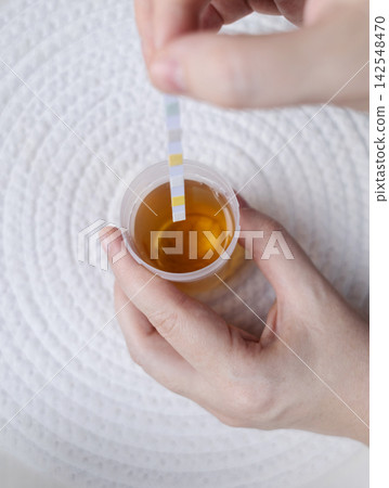 Person dipping a reagent test strip into a urine specimen container for medical analysis. Practical home diagnostic test checking health parameters and biomarkers. Person dipping a reagent test strip into a urine specimen container for medical analysis. Practical home diagnostic test checking health parameters and biomarkers. 142548470
