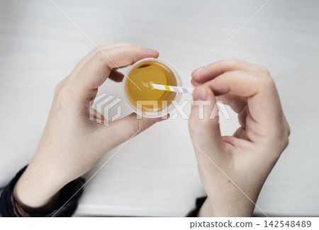 Person dipping a reagent test strip into a urine specimen container for medical analysis. Practical home diagnostic test checking health parameters and biomarkers. Person dipping a reagent test strip into a urine specimen container for medical analysis. Practical home diagnostic test checking health parameters and biomarkers. 142548489