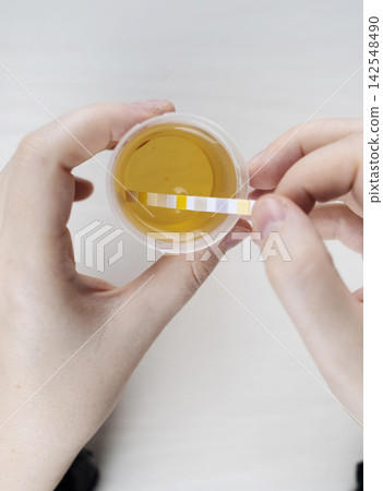 Person dipping a reagent test strip into a urine specimen container for medical analysis. Practical home diagnostic test checking health parameters and biomarkers. Person dipping a reagent test strip into a urine specimen container for medical analysis. Practical home diagnostic test checking health parameters and biomarkers. 142548490