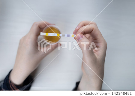 Person dipping a reagent test strip into a urine specimen container for medical analysis. Practical home diagnostic test checking health parameters and biomarkers. Person dipping a reagent test strip into a urine specimen container for medical analysis. Practical home diagnostic test checking health parameters and biomarkers. 142548491