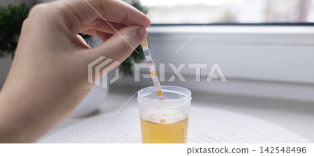 Person dipping a reagent test strip into a urine specimen container for medical analysis. Practical home diagnostic test checking health parameters and biomarkers. 142548496