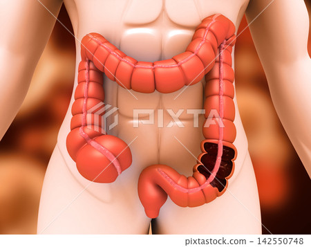 Human body anatomy, colon, large intestine 142550748