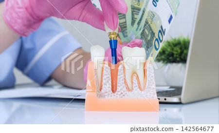 Dentist in pink medical gloves placing crown on dental implant model while holding euro banknotes. Dentist in pink medical gloves placing crown on dental implant model while holding euro banknotes. 142564677