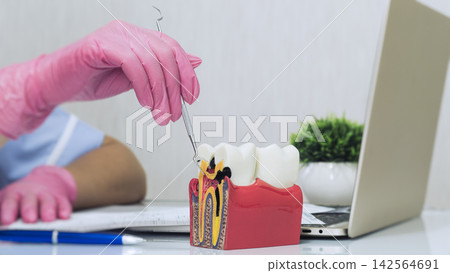 Dental professional explaining tooth decay and root canal anatomy using a colorful educational jaw model near a laptop in a modern medical office. Dental professional explaining tooth decay and root canal anatomy using a colorful educational jaw model near a laptop in a modern medical office. 142564691