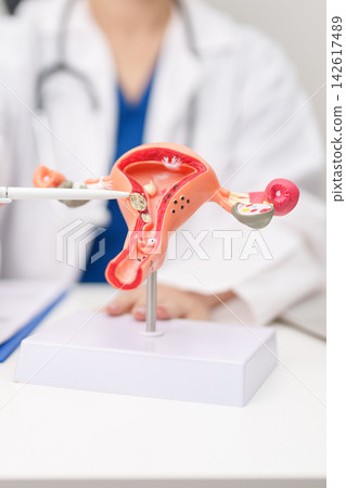 Doctor with Uterus and Ovaries anatomy model. Ovarian and Cervical cancer, Cervix disorder, Endometriosis, Hysterectomy, Uterine fibroids, Reproductive system, Pregnancy and health concept Doctor with Uterus and Ovaries anatomy model. Ovarian and Cervical cancer, Cervix disorder, Endometriosis, Hysterectomy, Uterine fibroids, Reproductive system, Pregnancy and health concept 142617489