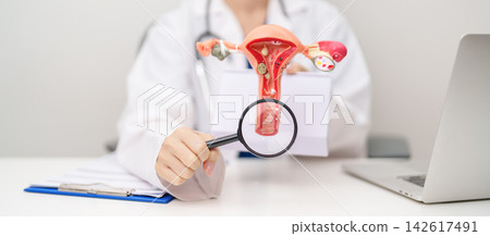 Doctor with Uterus and Ovaries anatomy model. Ovarian and Cervical cancer, Cervix disorder, Endometriosis, Hysterectomy, Uterine fibroids, Reproductive system, Pregnancy and health concept Doctor with Uterus and Ovaries anatomy model. Ovarian and Cervical cancer, Cervix disorder, Endometriosis, Hysterectomy, Uterine fibroids, Reproductive system, Pregnancy and health concept 142617491