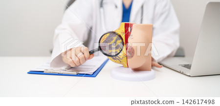 Doctor with Breast Anatomy model. Breast Augmentation Surgery, October Breast Cancer Awareness month, implant, Diagnosis, Beauty woman enlargement and medical education concept 142617498