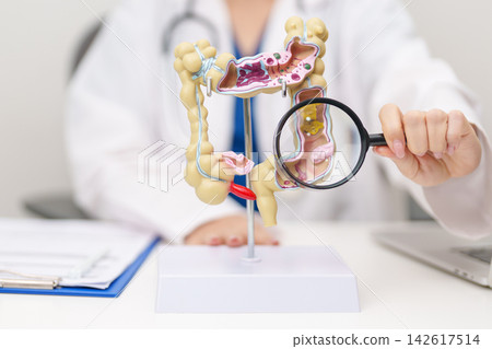 Doctor with human Colon anatomy model. Colonic disease, Large Intestine, Colorectal cancer, Ulcerative colitis, Diverticulitis, Irritable bowel syndrome, Digestive system and Healthcare concept 142617514