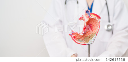 Doctor with Gastric anatomy model. Gastroenterologist consultation, stomach diseases and ulcers, November stomach cancer, Gastroesophageal Reflux Disease, GERD, Acid reflux and healthcare medical 142617536