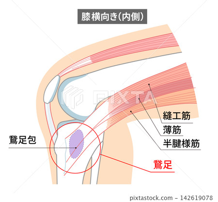 Anatomical diagram of the pes anserinus on the medial side of the knee joint and the sartorius, gracilis, and semitendinosus muscles. Anatomical diagram of the pes anserinus on the medial side of the knee joint and the sartorius, gracilis, and semitendinosus muscles. 142619078