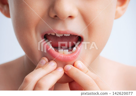 Close-up portrait of child with missing baby tooth, suitable for concepts related to children's healthcare, dental care, oral hygiene, tooth development and pediatric dentistry Close-up portrait of child with missing baby tooth, suitable for concepts related to children's healthcare, dental care, oral hygiene, tooth development and pediatric dentistry 142620077