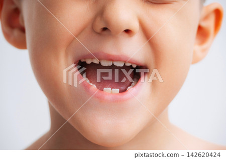 Child with missing baby teeth during the natural transition to permanent teeth. Pediatric dentistry and dental health concept, close-up on white background Child with missing baby teeth during the natural transition to permanent teeth. Pediatric dentistry and dental health concept, close-up on white background 142620424