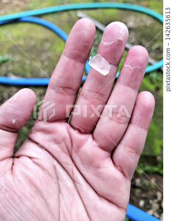 Detailed view of peeling skin on human fingers revealing dry damaged texture for dermatology medical assessment and health condition education. Detailed view of peeling skin on human fingers revealing dry damaged texture for dermatology medical assessment and health condition education. 142635613