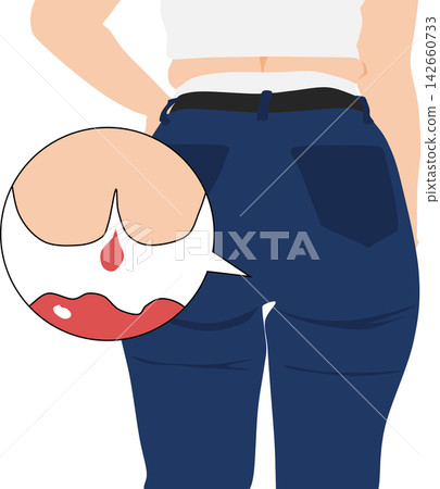Illustration of a woman suffering from hemorrhoids Illustration of a woman suffering from hemorrhoids 142660733