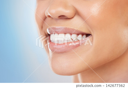 Female person, smile and zoom for treatment, filling and polish for cosmetic in blue background. Teeth, closeup and dental with hygiene, mouth and oral care for health, wellness and clean in studio Female person, smile and zoom for treatment, filling and polish for cosmetic in blue background. Teeth, closeup and dental with hygiene, mouth and oral care for health, wellness and clean in studio 142677362