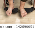 Elderly woman has edema or swelling foot. 142690051