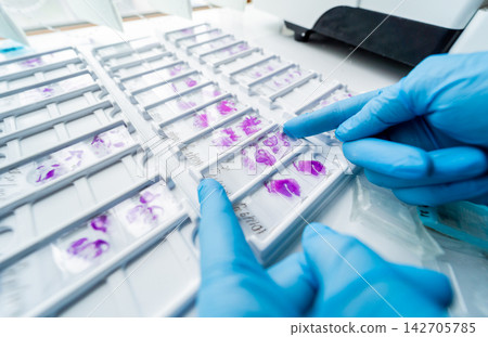 Hand in blue glove holding glass histology slides Hand in blue glove holding glass histology slides 142705785