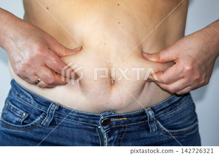 Middle-aged woman pinching belly fat above jeans showing abdominal skin and concern about weight Middle-aged woman pinching belly fat above jeans showing abdominal skin and concern about weight 142726321