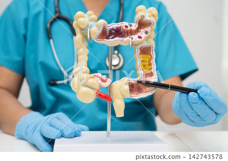 Intestine, doctor holding human anatomy model for study diagnosis and treatment in hospital. Intestine, doctor holding human anatomy model for study diagnosis and treatment in hospital. 142743578