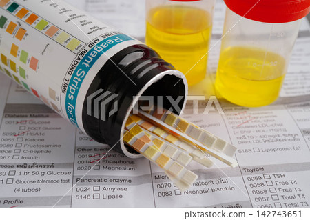 Urinalysis, urine cup with reagent strip pH paper test and comparison chart in laboratory. Urinalysis, urine cup with reagent strip pH paper test and comparison chart in laboratory. 142743651