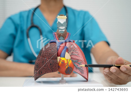 Pneumonia, lung cancer, Asian doctor with human lung model. Pneumonia, lung cancer, Asian doctor with human lung model. 142743693