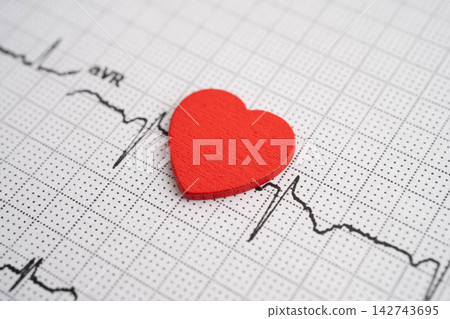 Electrocardiogram ECG, heart wave, heart attack, cardiogram report. 142743695