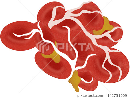 blood clot illustration blood clot illustration 142751909