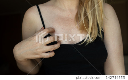 Close up of woman touching circular red skin spot on chest. Dermatological issue showing fungal infection, eczema, ringworm, rash, or contact dermatitis. Close up of woman touching circular red skin spot on chest. Dermatological issue showing fungal infection, eczema, ringworm, rash, or contact dermatitis. 142754355