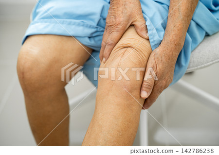 Asian elderly woman patient show her scars surgical total knee joint replacement Suture wound surgery arthroplasty on bed in hospital. Asian elderly woman patient show her scars surgical total knee joint replacement Suture wound surgery arthroplasty on bed in hospital. 142786238