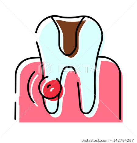 Tooth showing caries decay and gum abscess Tooth showing caries decay and gum abscess 142794297