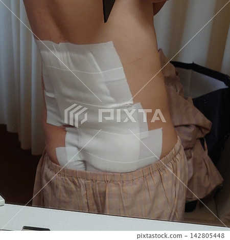 A large piece of gauze and protective tape (bandage) were applied after back surgery. A large piece of gauze and protective tape (bandage) were applied after back surgery. 142805448