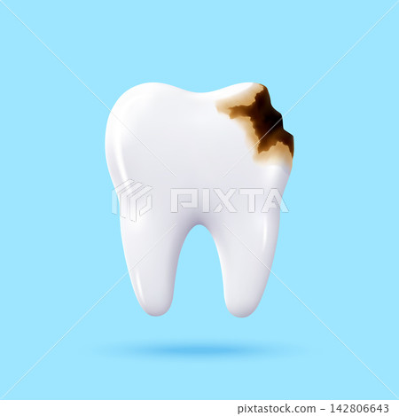 3d realistic tooth with brown caries decay 3d realistic tooth with brown caries decay 142806643