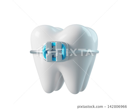 3d Tooth with a bracket frame, realistic render icon isolated on white background. Infographics installation of corrective brace 3d Tooth with a bracket frame, realistic render icon isolated on white background. Infographics installation of corrective brace 142806966