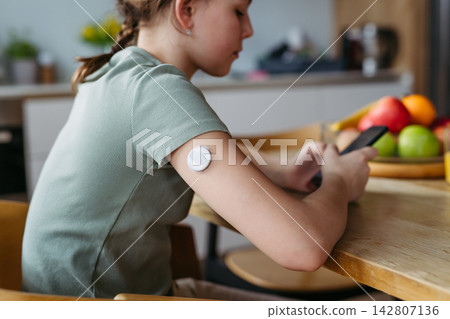 Teen girl with diabetes checking glucose results on smartphone after CGM scan. Teen girl with diabetes checking glucose results on smartphone after CGM scan. 142807136