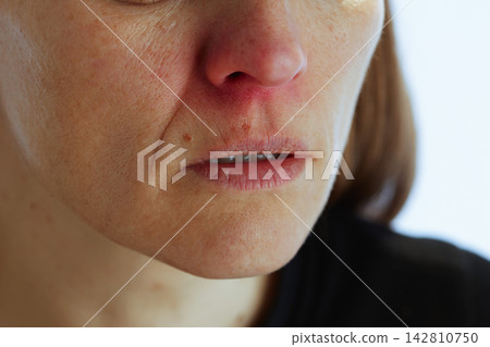 Middle-Aged Woman Showing Cold and Flu Symptoms Middle-Aged Woman Showing Cold and Flu Symptoms 142810750
