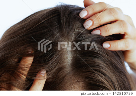 Woman Examining Scalp for Dandruff and Dryness Woman Examining Scalp for Dandruff and Dryness 142810759
