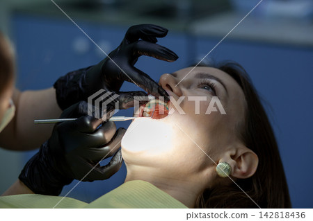 Installing a retainer after wearing braces. The process of removing braces.Beautiful woman in dental chair during procedure of installing braces to upper and lower teeth. Dentist and assistant working Installing a retainer after wearing braces. The process of removing braces.Beautiful woman in dental chair during procedure of installing braces to upper and lower teeth. Dentist and assistant working 142818436