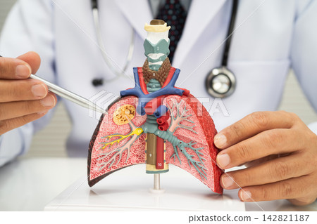 Pneumonia, lung cancer, Asian doctor with human lung model. Pneumonia, lung cancer, Asian doctor with human lung model. 142821187