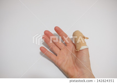 Right hand covered with gauze and tape (woman in her 40s) Right hand covered with gauze and tape (woman in her 40s) 142824351