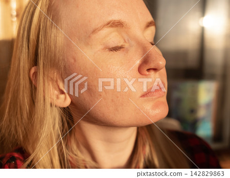 Close up of woman with oily skin, enlarged pores, and redness. She touches her face showing skin texture, acne scars, and pigmentation during a dermatology skincare routine. Close up of woman with oily skin, enlarged pores, and redness. She touches her face showing skin texture, acne scars, and pigmentation during a dermatology skincare routine. 142829863