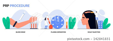 PRP procedure for female hair loss in three steps: blood draw, plasma separation and scalp injection. Platelet rich plasma therapy for alopecia. Flat vector illustration PRP procedure for female hair loss in three steps: blood draw, plasma separation and scalp injection. Platelet rich plasma therapy for alopecia. Flat vector illustration 142841831