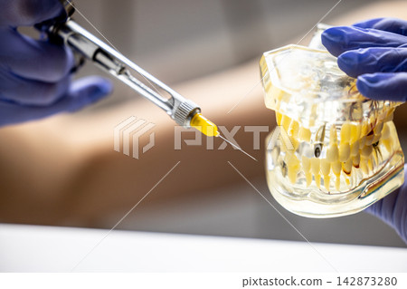 Dentist performing anesthetic injection with syringe and needle transparent jaw 142873280