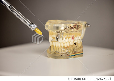 Dentist performing anesthetic injection on dental jaw model close Dentist performing anesthetic injection on dental jaw model close 142873291
