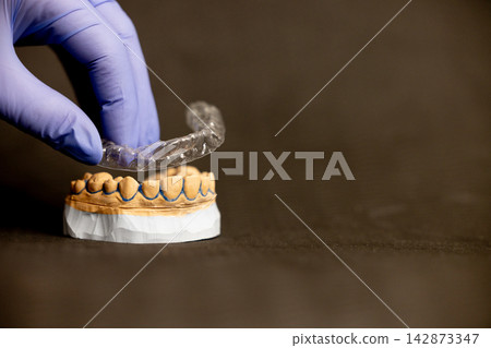 Clear aligner orthodontic tray placed on dental model Clear aligner orthodontic tray placed on dental model 142873347