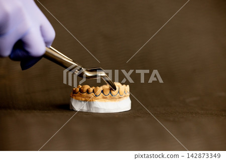 Clear aligner orthodontic tray placed on dental model Clear aligner orthodontic tray placed on dental model 142873349