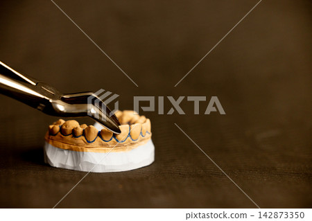 Clear aligner orthodontic tray placed on dental model Clear aligner orthodontic tray placed on dental model 142873350