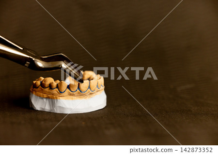 Clear aligner orthodontic tray placed on dental model Clear aligner orthodontic tray placed on dental model 142873352
