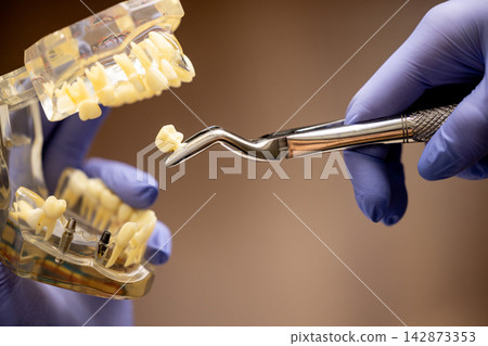 Dental spoon held by dentist over transparent jaw typodont for clinical procedure Dental spoon held by dentist over transparent jaw typodont for clinical procedure 142873353